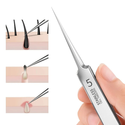 Blackhead Tweezers, Stainless Steel Fine Tip Pore Tool